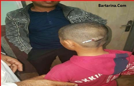 تنبیه دانش آموز توسط معلم در رودبار با فرو کردن مداد در سرش